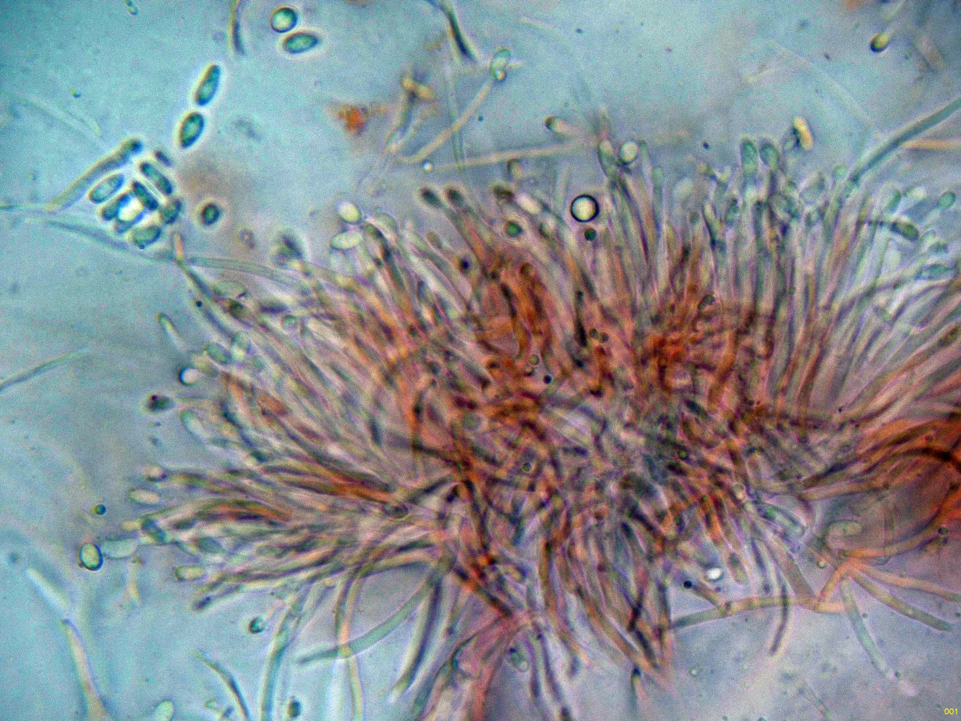 Microscopía de Tubercularia lateritia - 10 - Hifas conidiógenas -001